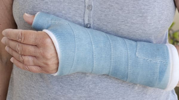 scaphoide fracture osteosynthese fracture poignet docteur laurent thomsen clinique drouot paris 9