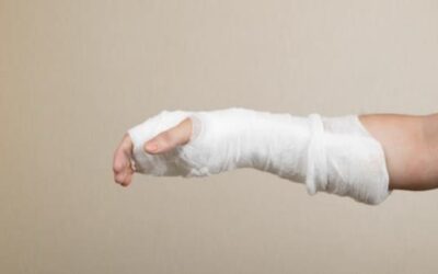 Fracture scaphoïde : les gestes à éviter et les suites opératoires