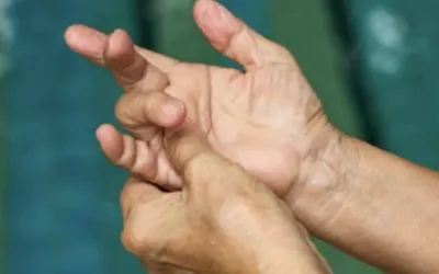 Opération du doigt à ressaut : quelle convalescence ?