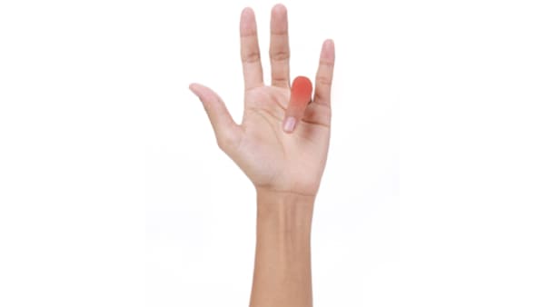 Quelles sont les complications après une opération du doigt à ressaut ?