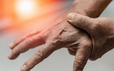 Arthroplastie totale trapézo-métacarpienne : Tout ce qu’il faut savoir