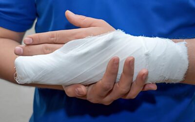Maladie de Dupuytren : rééducation de la main après opération – Que faut-il savoir ?