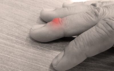 Tumeur glomique au doigt : pourquoi faire un IRM ?