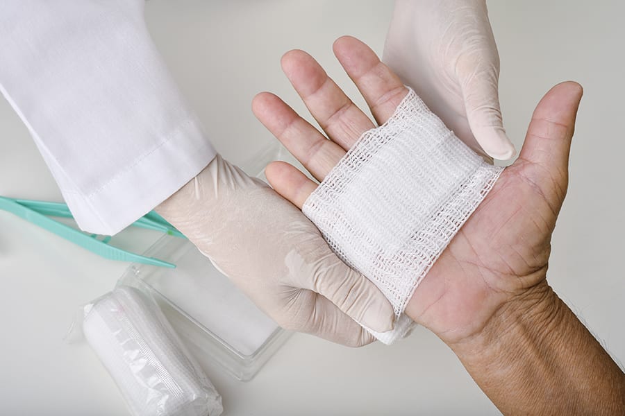 tumeur glucomique maligne chirurgie main paris chirurgien orthopediste main dr laurent thomsen paris