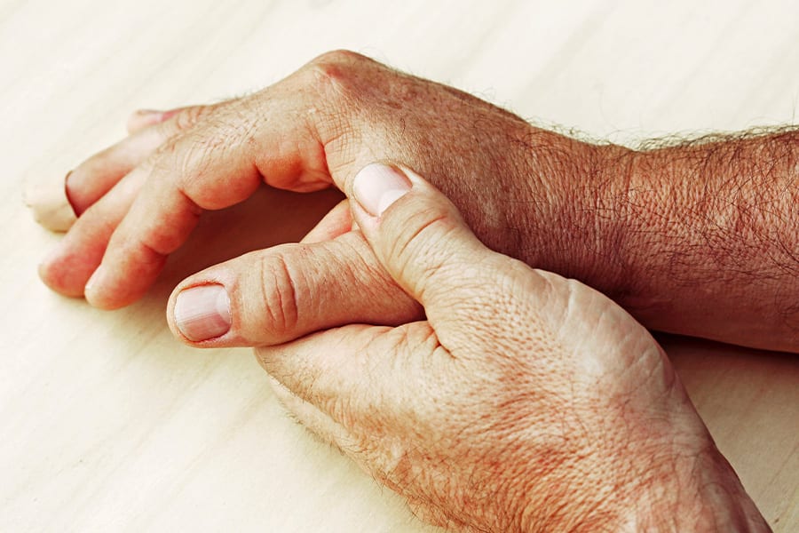 arthroplastie trapezometacarpienne trapezectomie arthroscopique chirurgie main paris chirurgien orthopediste main dr laurent thomsen paris arthroplastie trapezometacarpienne trapezectomie arthroscopique chirurgie main paris chirurgien orthopediste main dr laurent thomsen paris